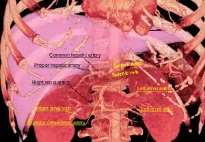 3D-rendered computed tomography, showing one renal vein (in red color) for each kidney
