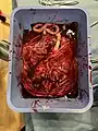 Healthy Placenta immediately post birth