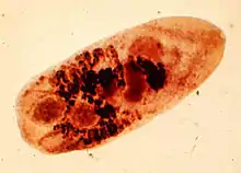 "Metagonimus yokogawai" specimen