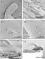 SEM of mature specimens of Echinorhynchus baeri