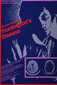 Teal and gray poster with red-orange and lavender lettering and highlights, announcing lecture, April 1985. Also lists speaker, sponsors, date, time, and location. Speaker was Joseph B. Martin, M.D., Ph.D., Professor of Neurology, Harvard Medical School. Largest feature of poster is computer-generated image of human head and torso. Smaller, clearer image of two brain scans, bounded by lavender, is superimposed on human figure.