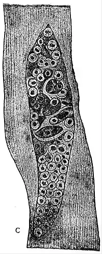 EB1911 Endospora - growth of Sarcocystis tenella of the sheep (C).jpg